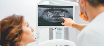 Dental X Ray
