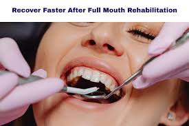 Full Mouth Rehabilitation